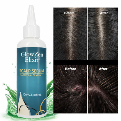 GlowZen Elixir Scalp Serum – Dandruff Relief & Hydration